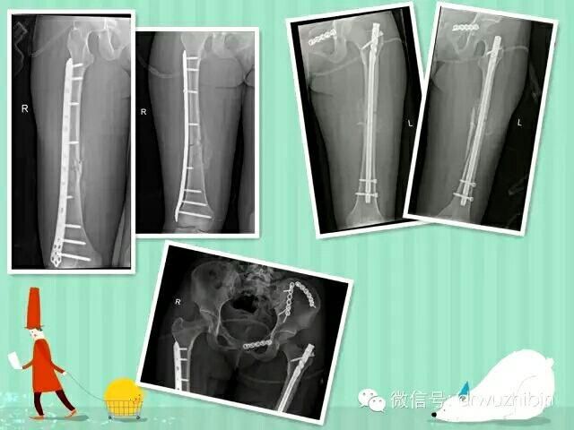 多發性創傷  永遠的挑戰